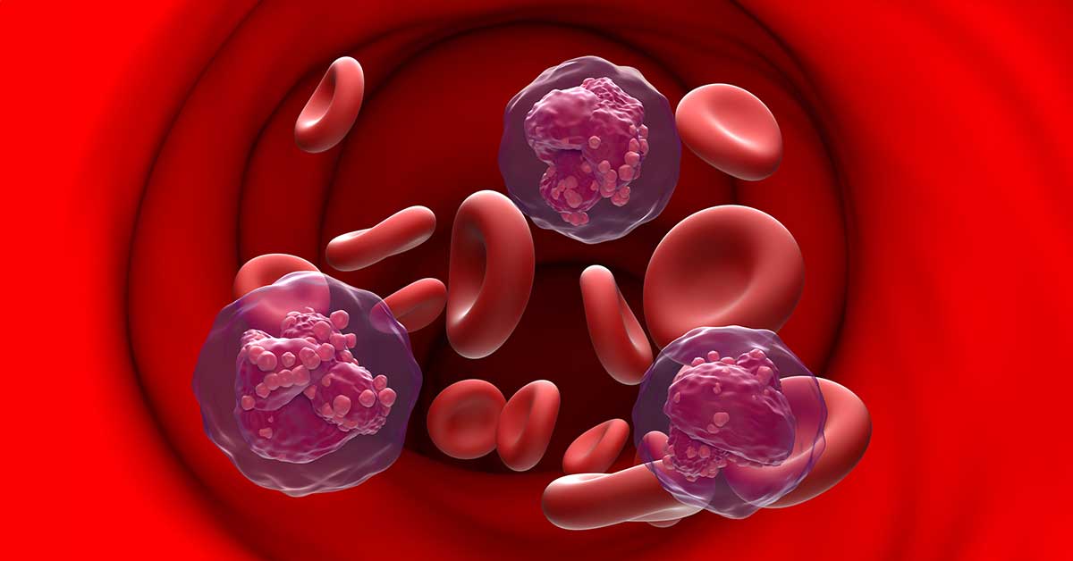 Acute lymphoblastic leukemia (ALL) cancer cell in blood flow - section view 3d illustration