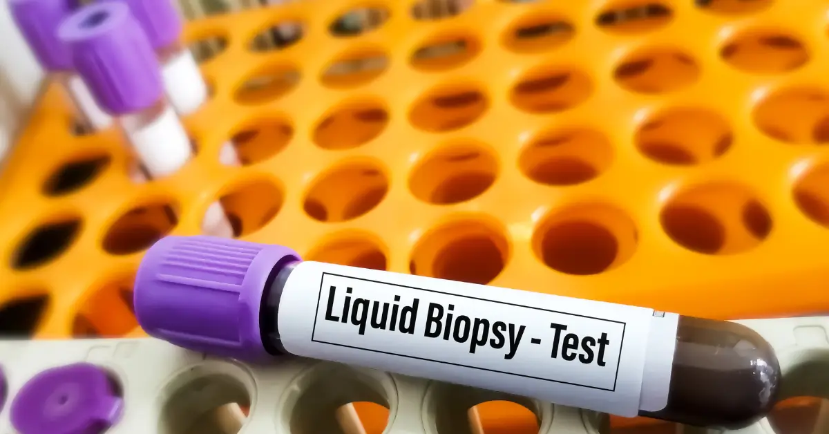 FCS launches liquid biopsy testing.