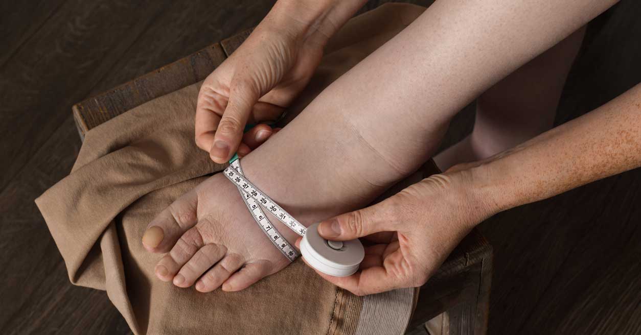 Woman measuring foot affected by lymphedema condition
